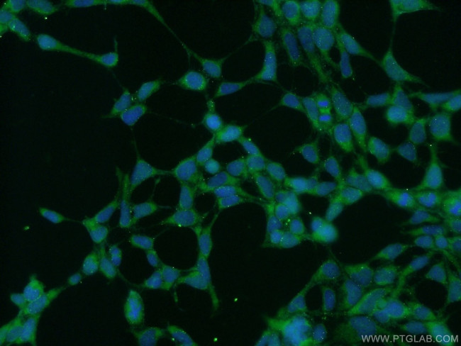 ZRANB3 Antibody in Immunocytochemistry (ICC/IF)