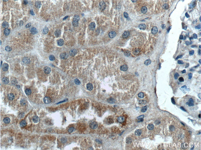 ZRANB3 Antibody in Immunohistochemistry (Paraffin) (IHC (P))