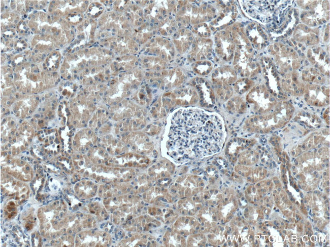 ZRANB3 Antibody in Immunohistochemistry (Paraffin) (IHC (P))