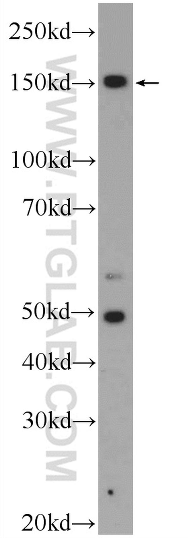 ZRANB3 Antibody in Western Blot (WB)