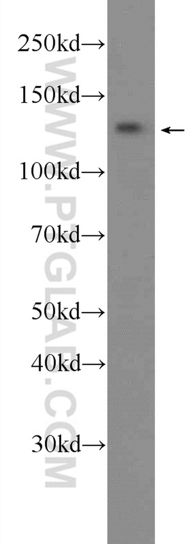 SALL2 Antibody in Western Blot (WB)