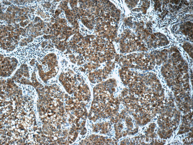 Secretin Antibody in Immunohistochemistry (Paraffin) (IHC (P))