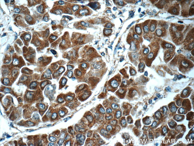 Secretin Antibody in Immunohistochemistry (Paraffin) (IHC (P))