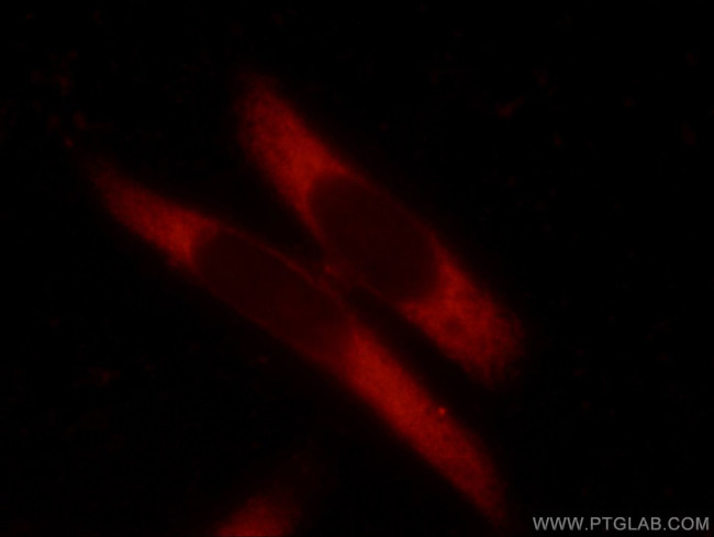 TMEM127 Antibody in Immunocytochemistry (ICC/IF)