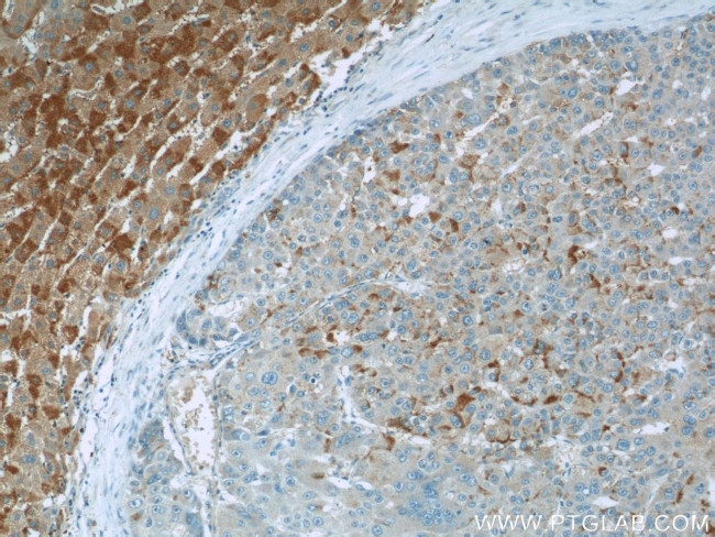 TMEM127 Antibody in Immunohistochemistry (Paraffin) (IHC (P))