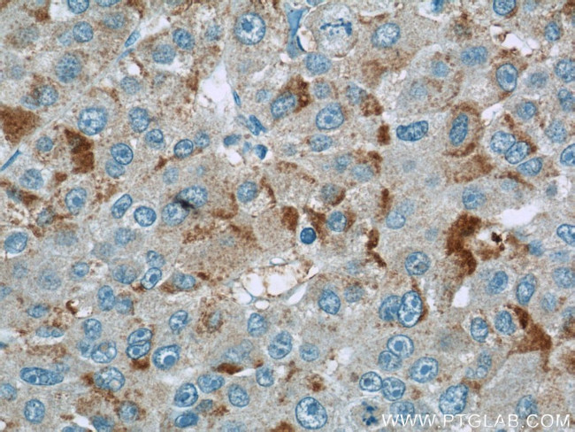 TMEM127 Antibody in Immunohistochemistry (Paraffin) (IHC (P))