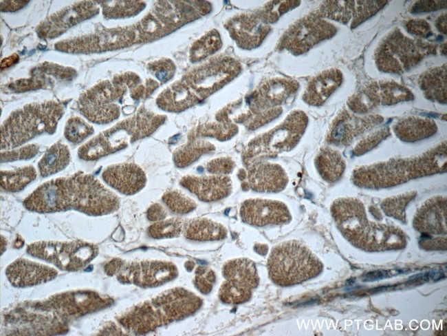 TMEM127 Antibody in Immunohistochemistry (Paraffin) (IHC (P))