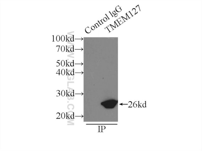 TMEM127 Antibody in Immunoprecipitation (IP)