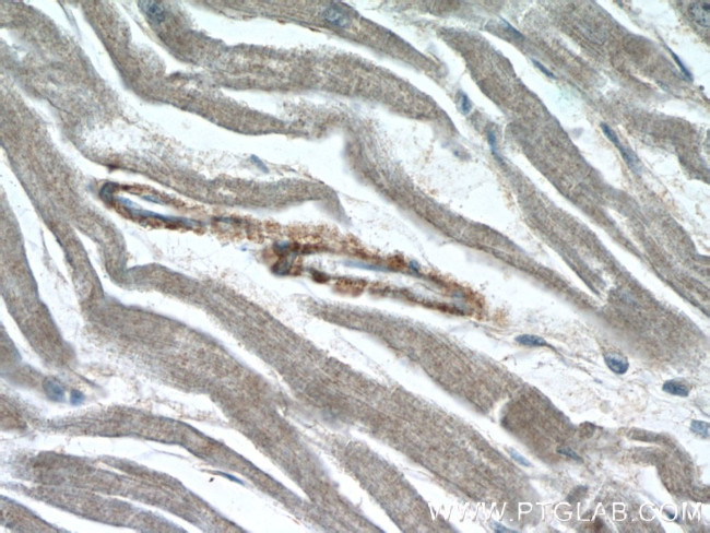 ZFYVE19 Antibody in Immunohistochemistry (Paraffin) (IHC (P))