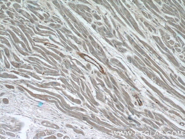 ZFYVE19 Antibody in Immunohistochemistry (Paraffin) (IHC (P))