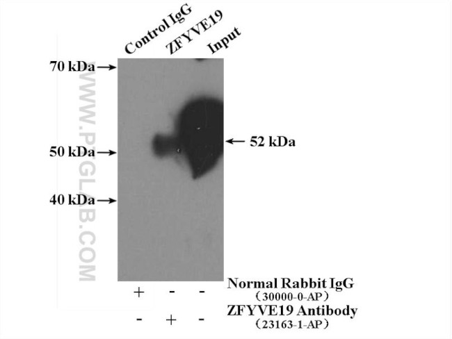 ZFYVE19 Antibody in Immunoprecipitation (IP)