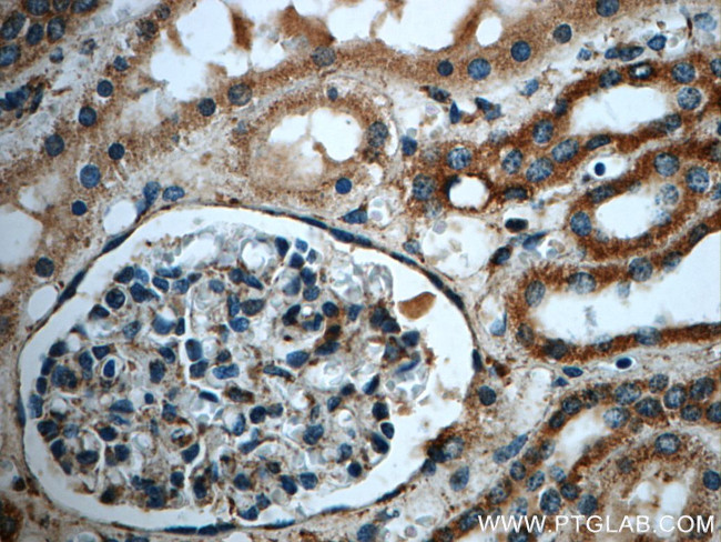 MGME1 Antibody in Immunohistochemistry (Paraffin) (IHC (P))