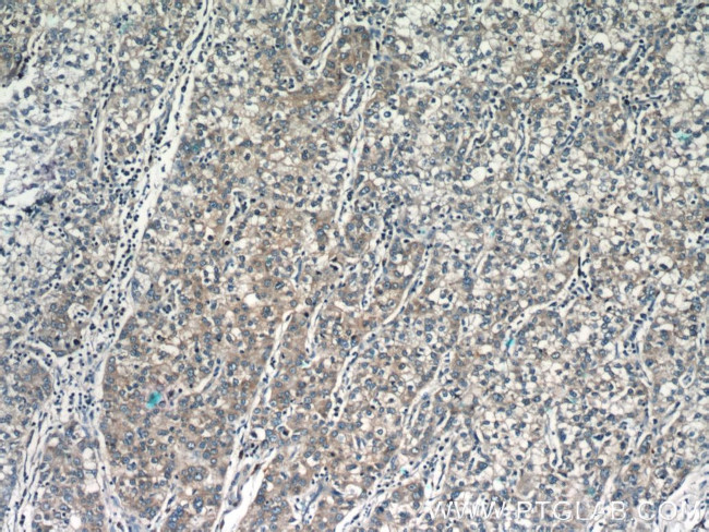 MGME1 Antibody in Immunohistochemistry (Paraffin) (IHC (P))