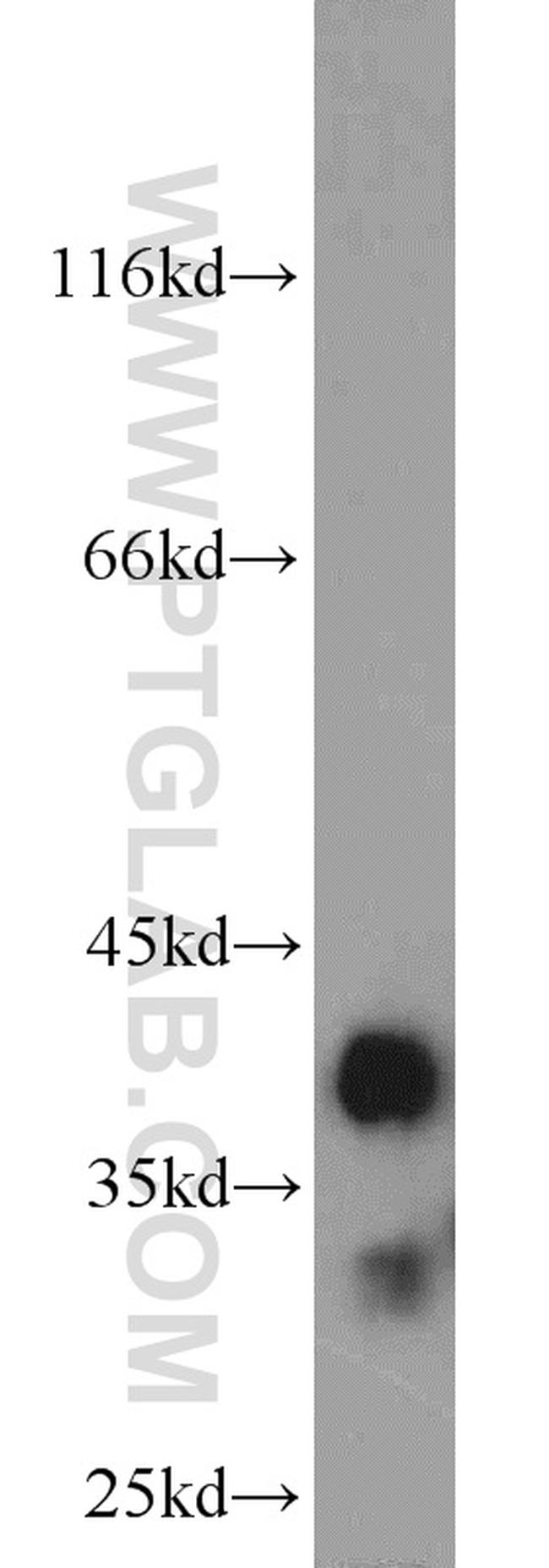 MGME1 Antibody in Western Blot (WB)