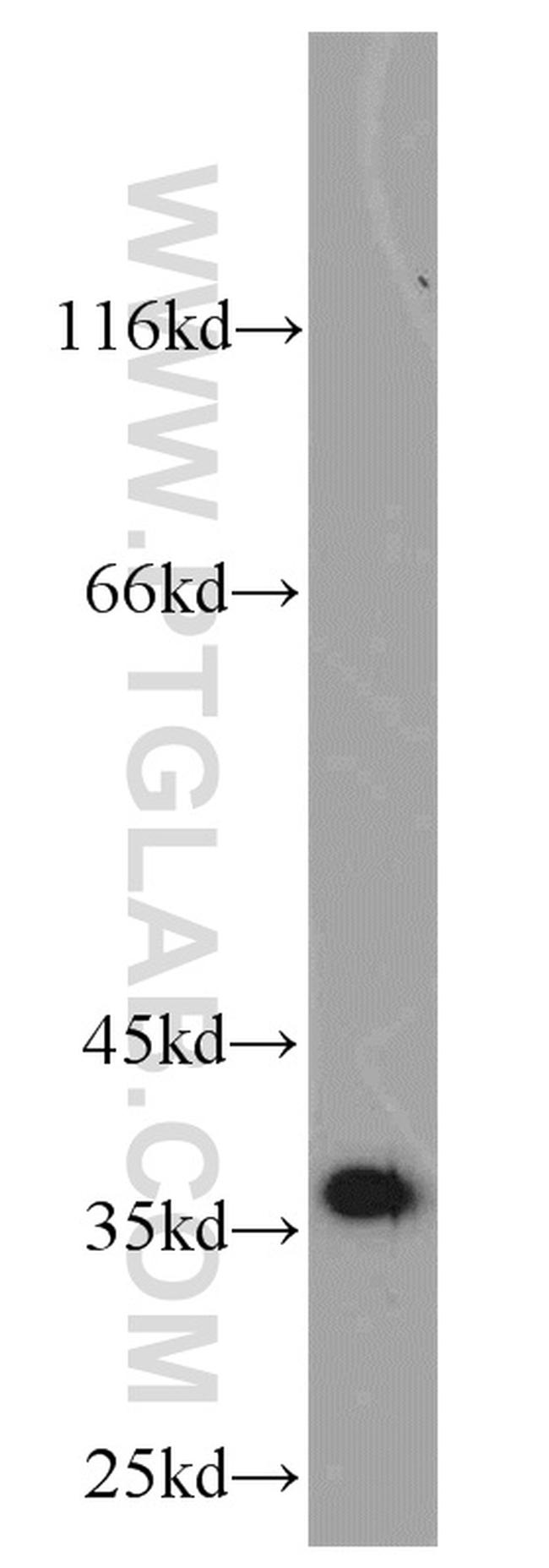 MGME1 Antibody in Western Blot (WB)