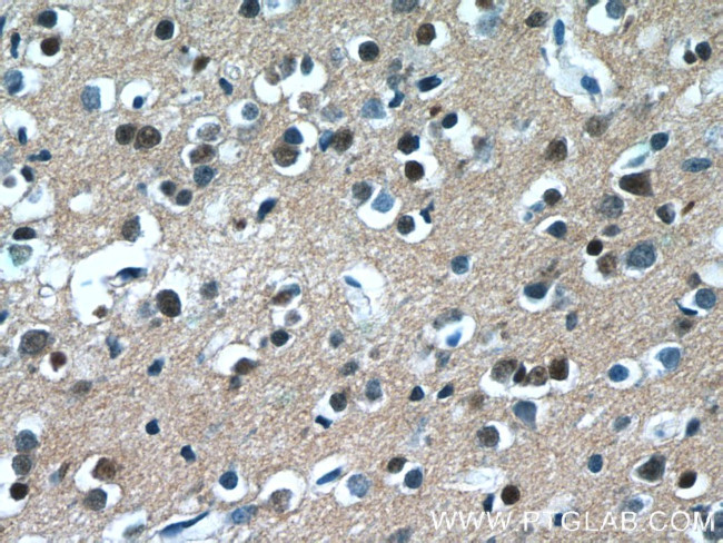 C20orf194 Antibody in Immunohistochemistry (Paraffin) (IHC (P))