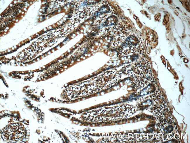 C20orf194 Antibody in Immunohistochemistry (Paraffin) (IHC (P))