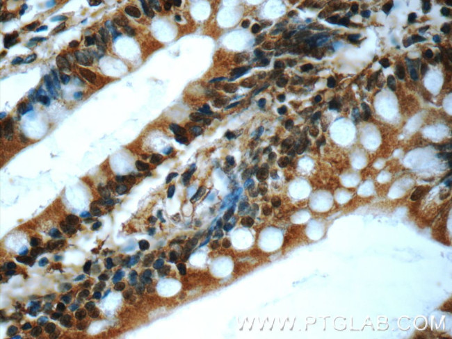 C20orf194 Antibody in Immunohistochemistry (Paraffin) (IHC (P))