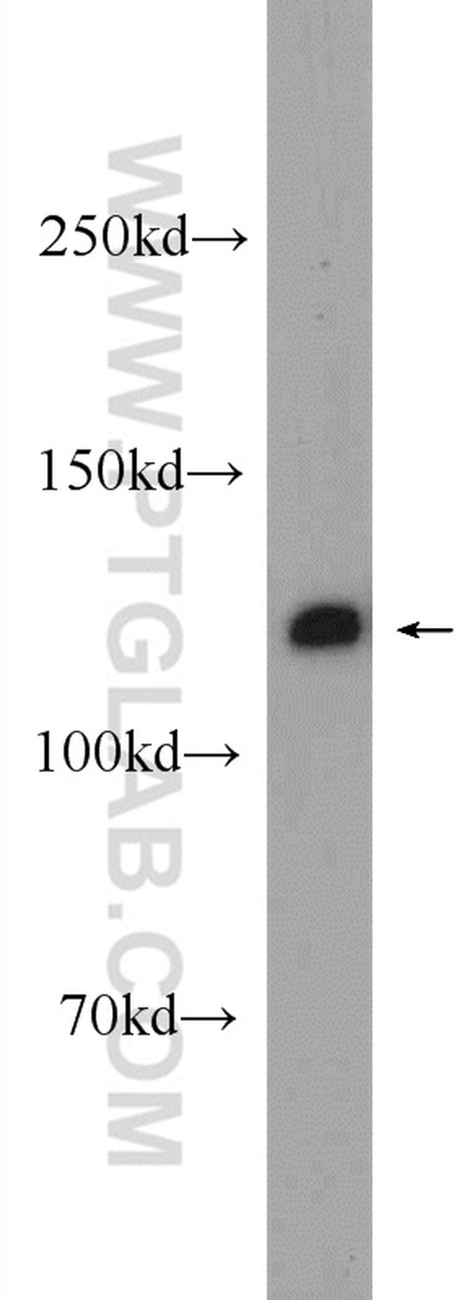 C20orf194 Antibody in Western Blot (WB)