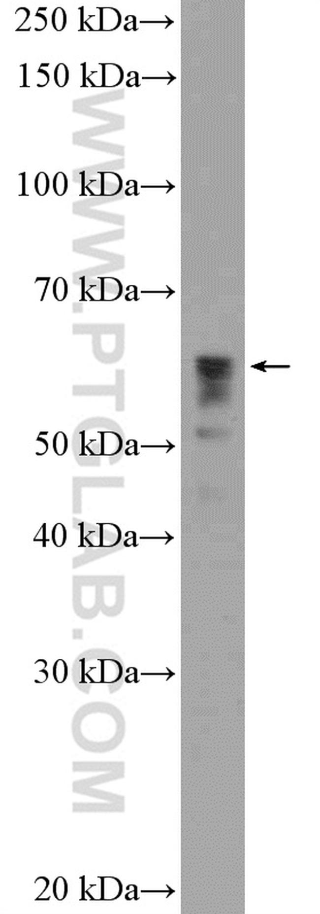 P4HA3 Antibody in Western Blot (WB)