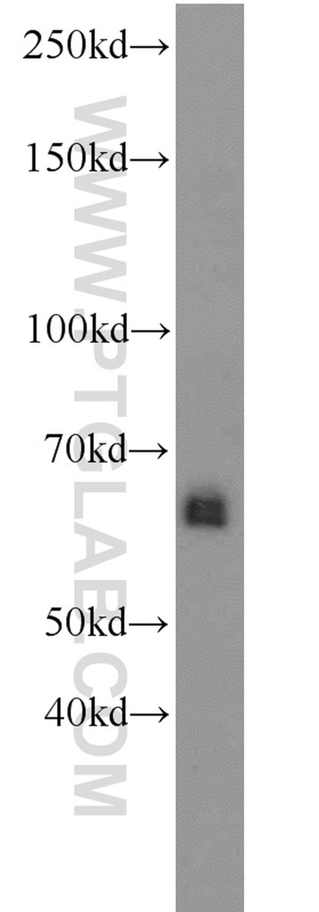 ZGPAT Antibody in Western Blot (WB)