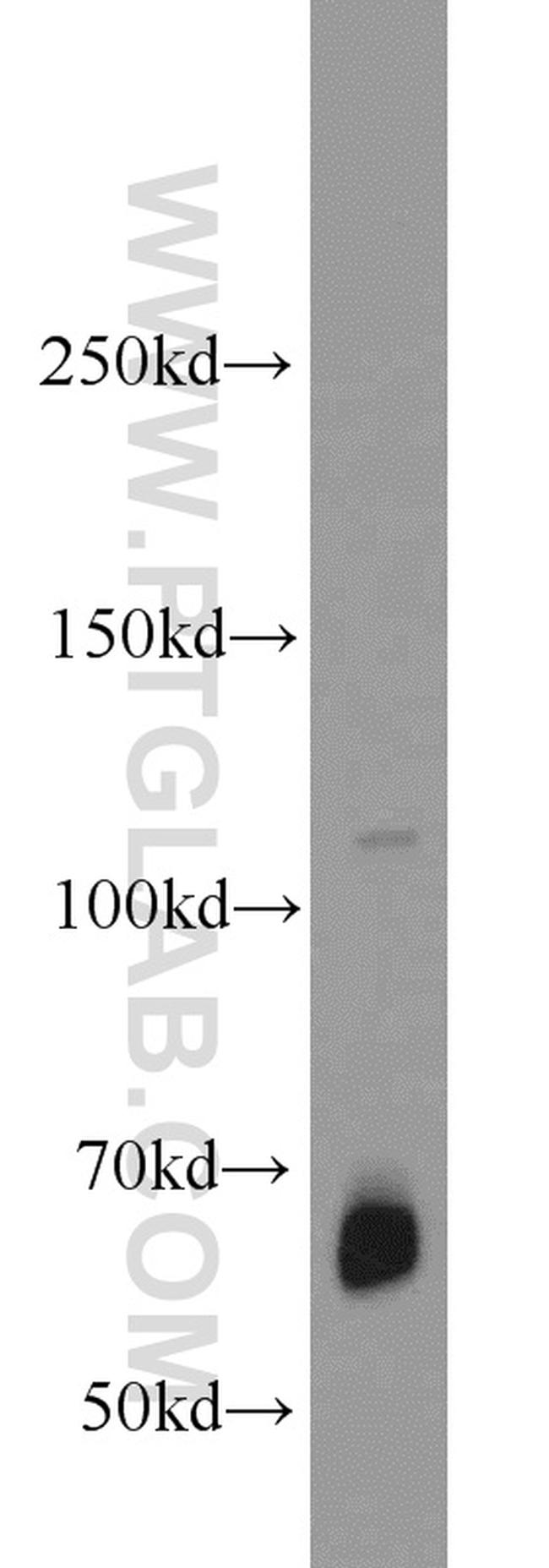 ZGPAT Antibody in Western Blot (WB)