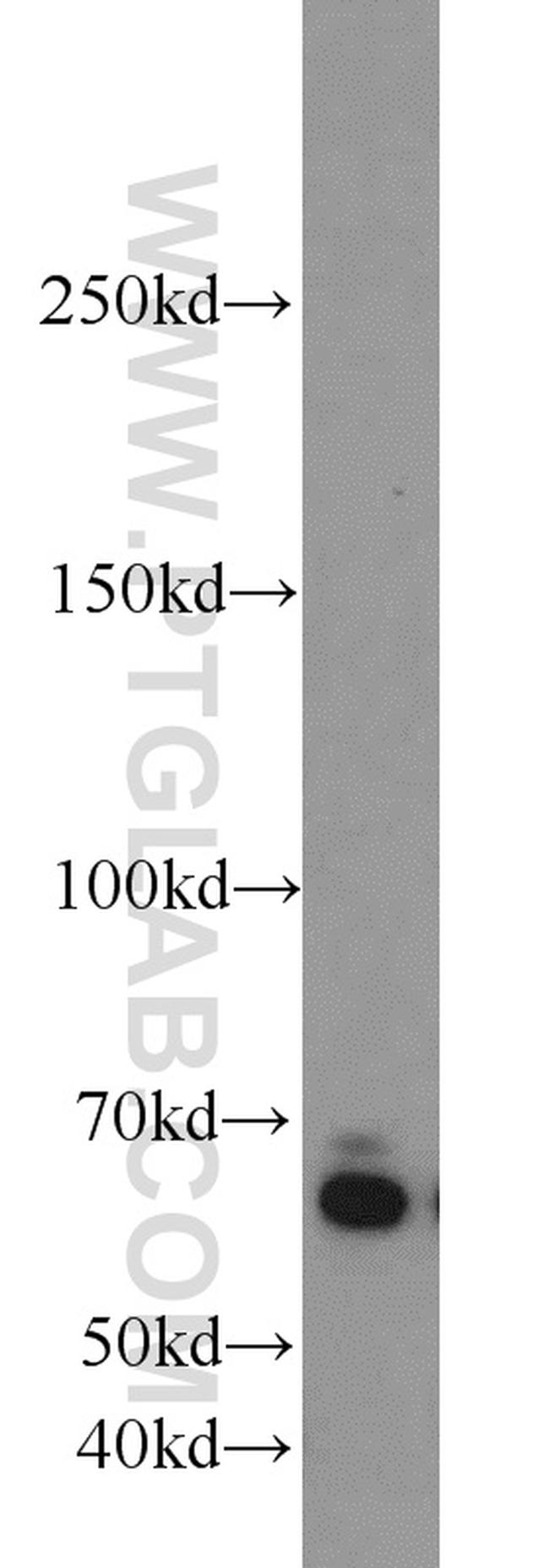 ZGPAT Antibody in Western Blot (WB)