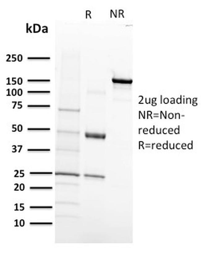 VEGF-R1/FLT-1 Antibody in SDS-PAGE (SDS-PAGE)