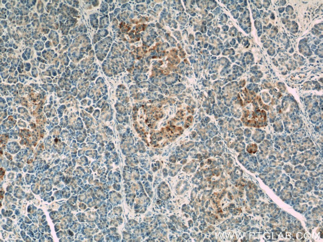 LRRC47 Antibody in Immunohistochemistry (Paraffin) (IHC (P))