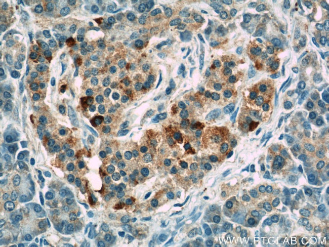 LRRC47 Antibody in Immunohistochemistry (Paraffin) (IHC (P))