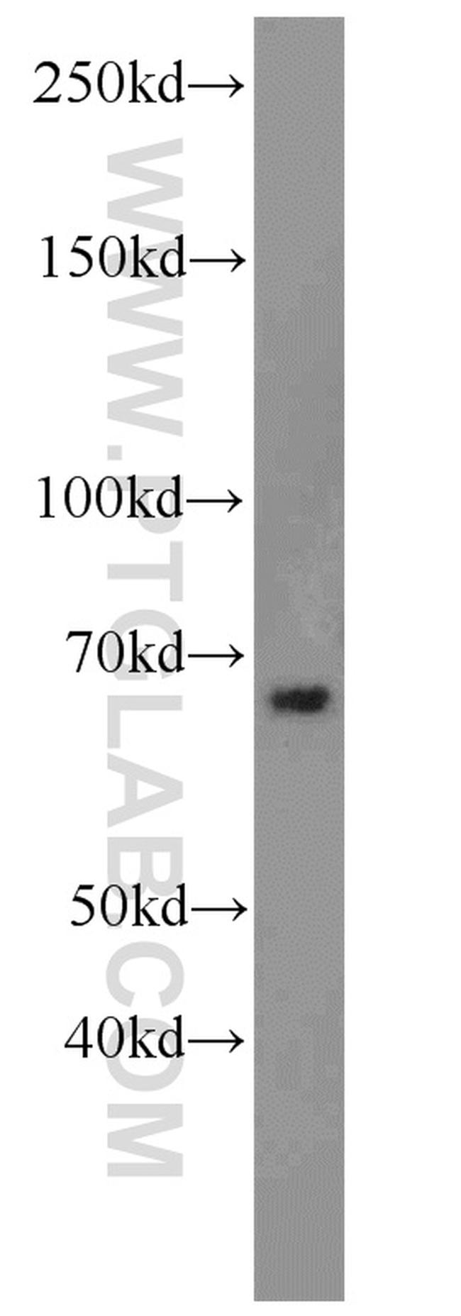 LRRC47 Antibody in Western Blot (WB)