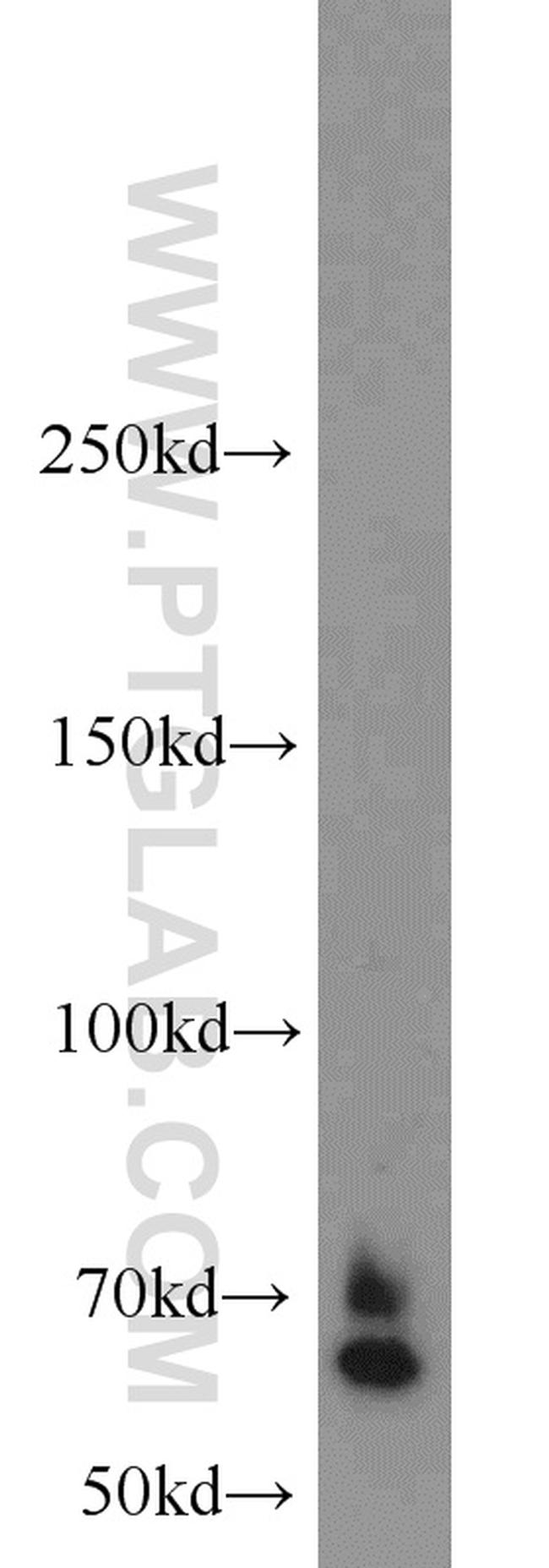 LRRC47 Antibody in Western Blot (WB)