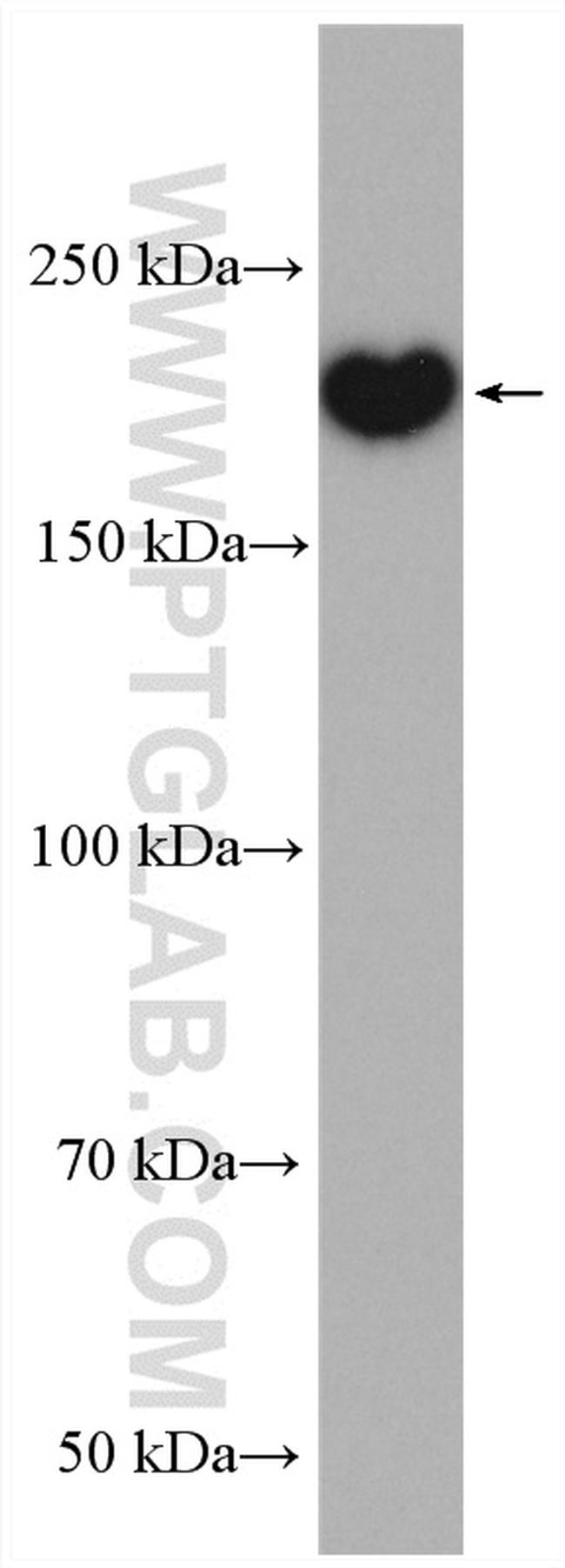 ATG2A Antibody in Western Blot (WB)