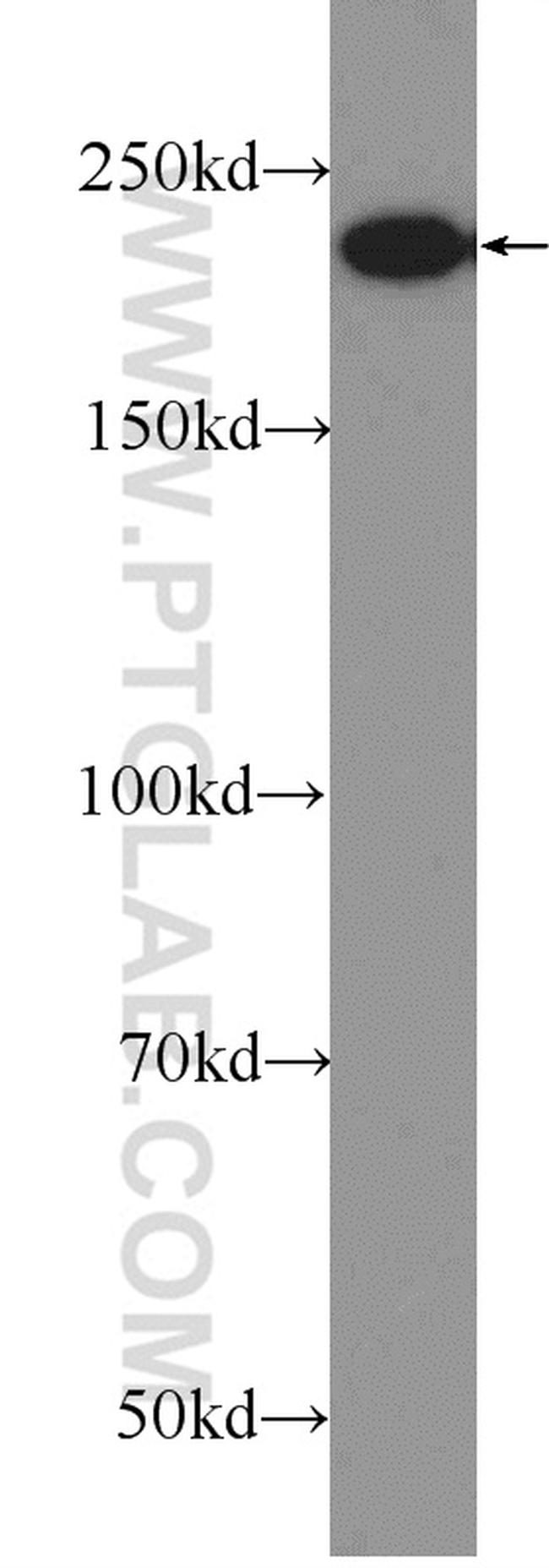 ATG2A Antibody in Western Blot (WB)