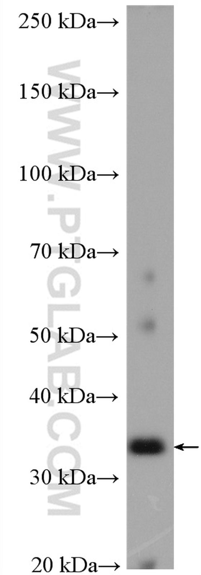 MYD88 Antibody in Western Blot (WB)