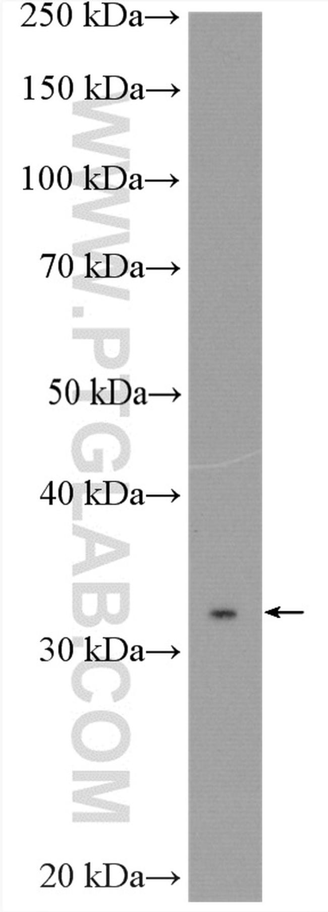 MYD88 Antibody in Western Blot (WB)