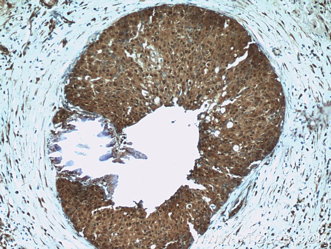 TBX18 Antibody in Immunohistochemistry (Paraffin) (IHC (P))