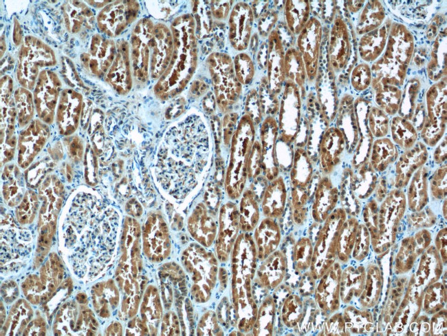 TBX18 Antibody in Immunohistochemistry (Paraffin) (IHC (P))