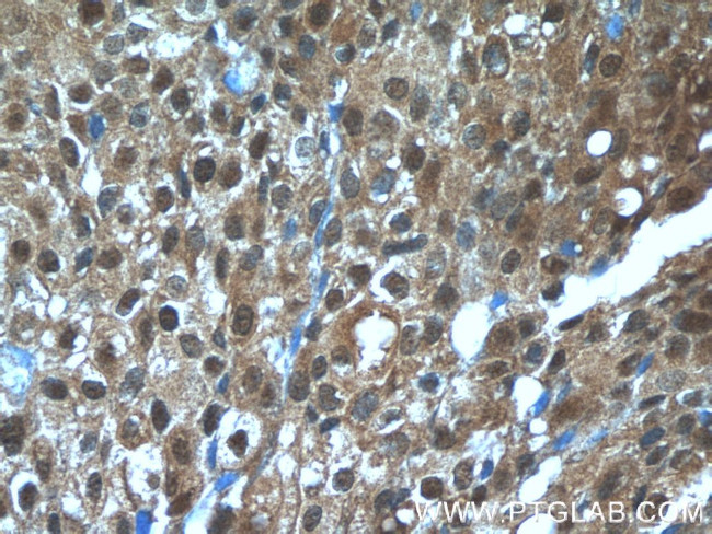 TBX18 Antibody in Immunohistochemistry (Paraffin) (IHC (P))