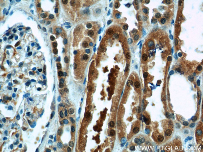 TBX18 Antibody in Immunohistochemistry (Paraffin) (IHC (P))