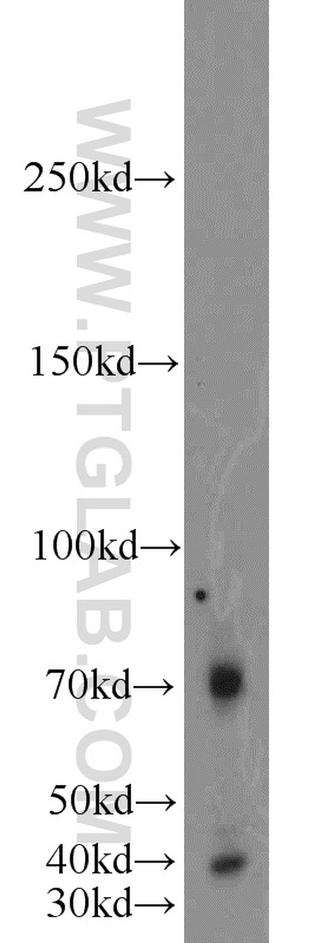 TBX18 Antibody in Western Blot (WB)