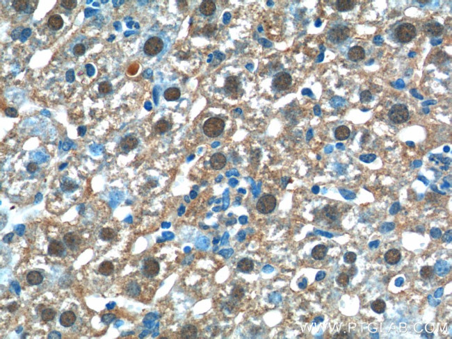 C11orf54 Antibody in Immunohistochemistry (Paraffin) (IHC (P))