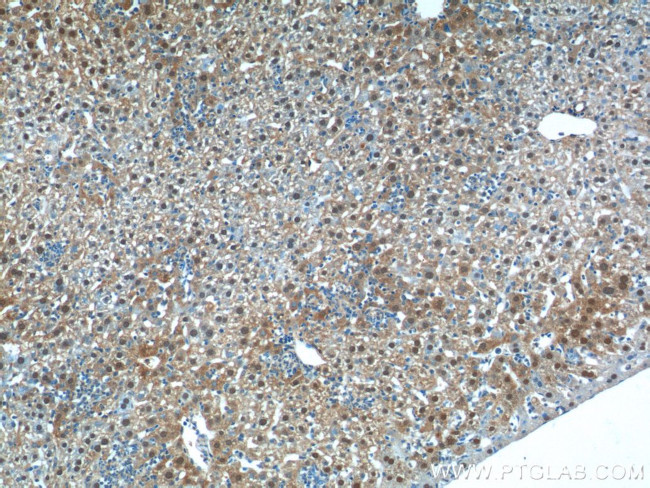 C11orf54 Antibody in Immunohistochemistry (Paraffin) (IHC (P))