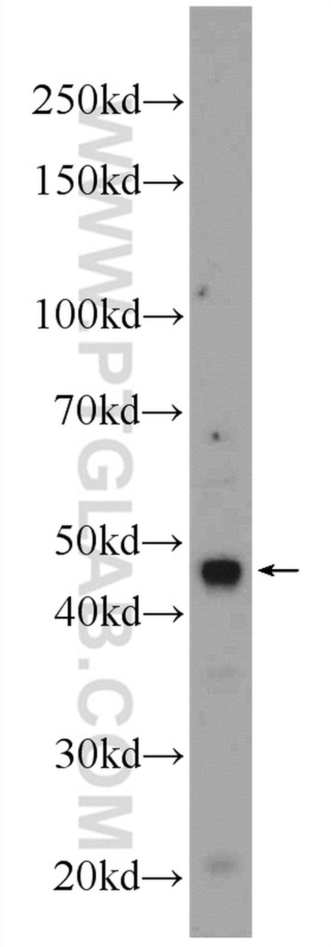 KCNN4 Antibody in Western Blot (WB)