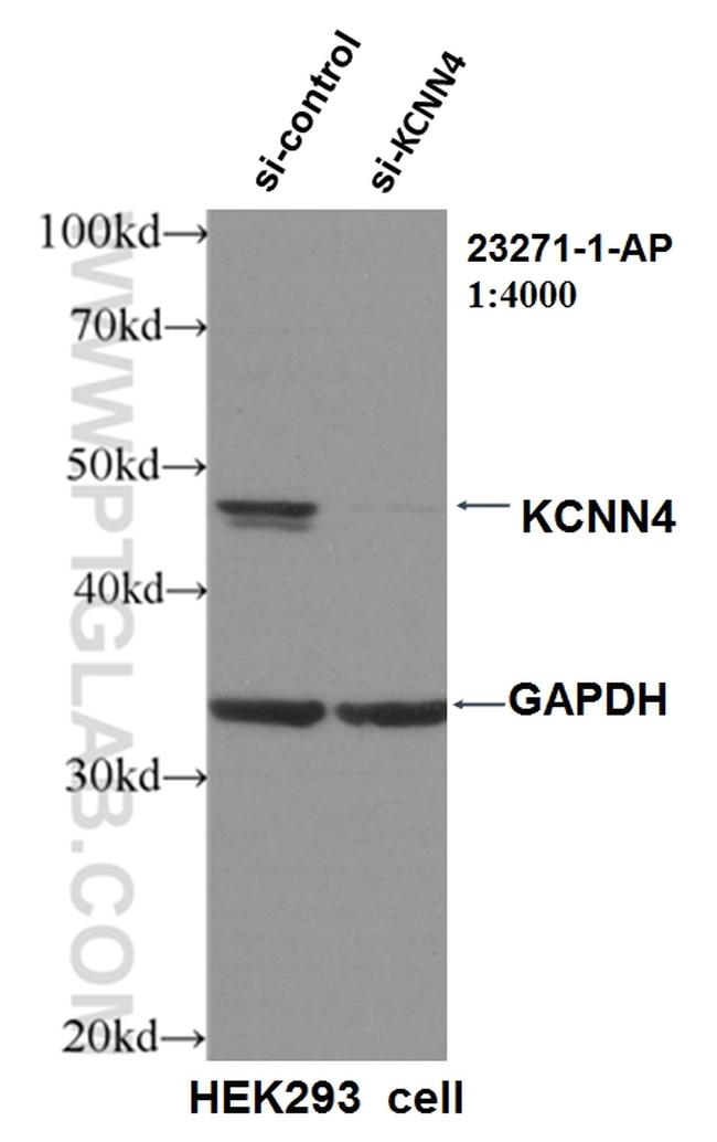 KCNN4 Antibody in Western Blot (WB)