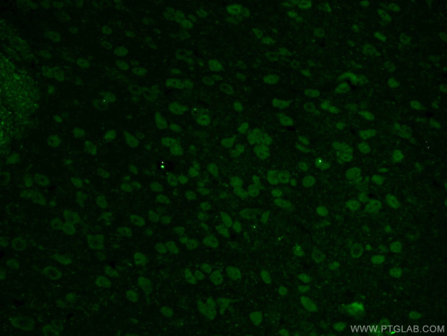 PINK1 Antibody in Immunohistochemistry (PFA fixed) (IHC (PFA))