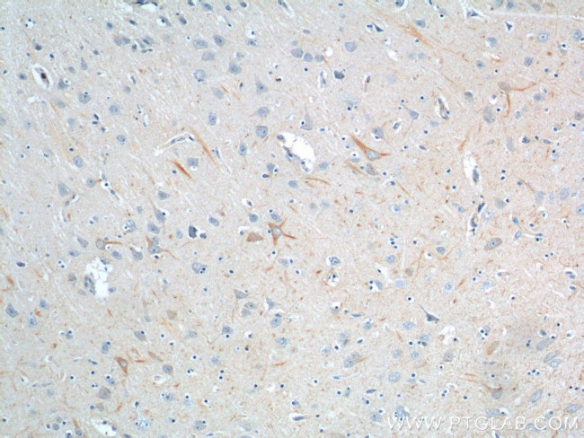 PINK1 Antibody in Immunohistochemistry (Paraffin) (IHC (P))