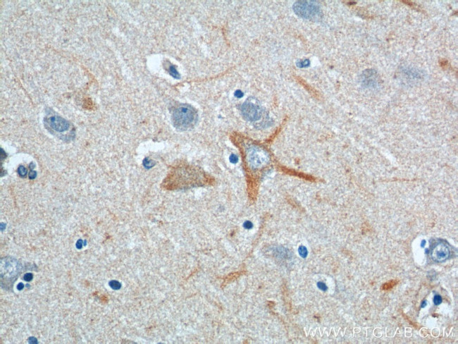 PINK1 Antibody in Immunohistochemistry (Paraffin) (IHC (P))