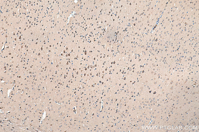 PINK1 Antibody in Immunohistochemistry (Paraffin) (IHC (P))