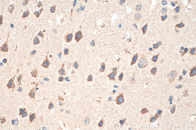 PINK1 Antibody in Immunohistochemistry (Paraffin) (IHC (P))